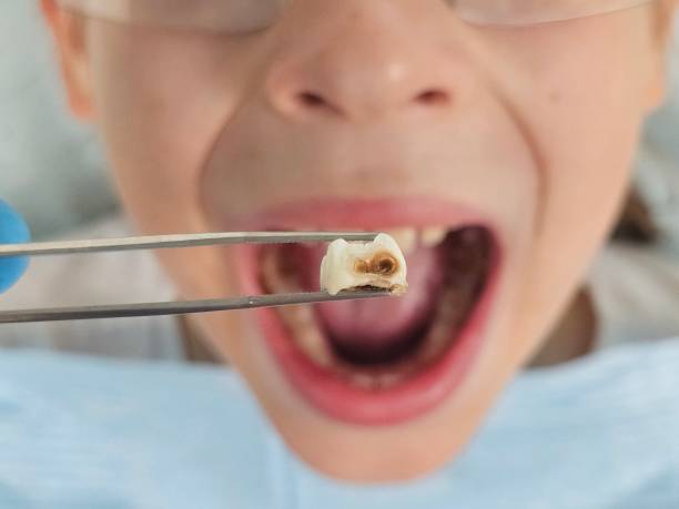 Best Emergency Care for Gum Disease in Blackhawk, CA